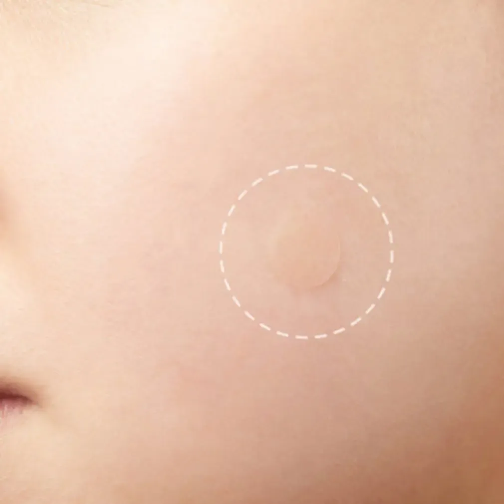 Invisible Hydrocolloid Acne Patches, 24 Pieces
