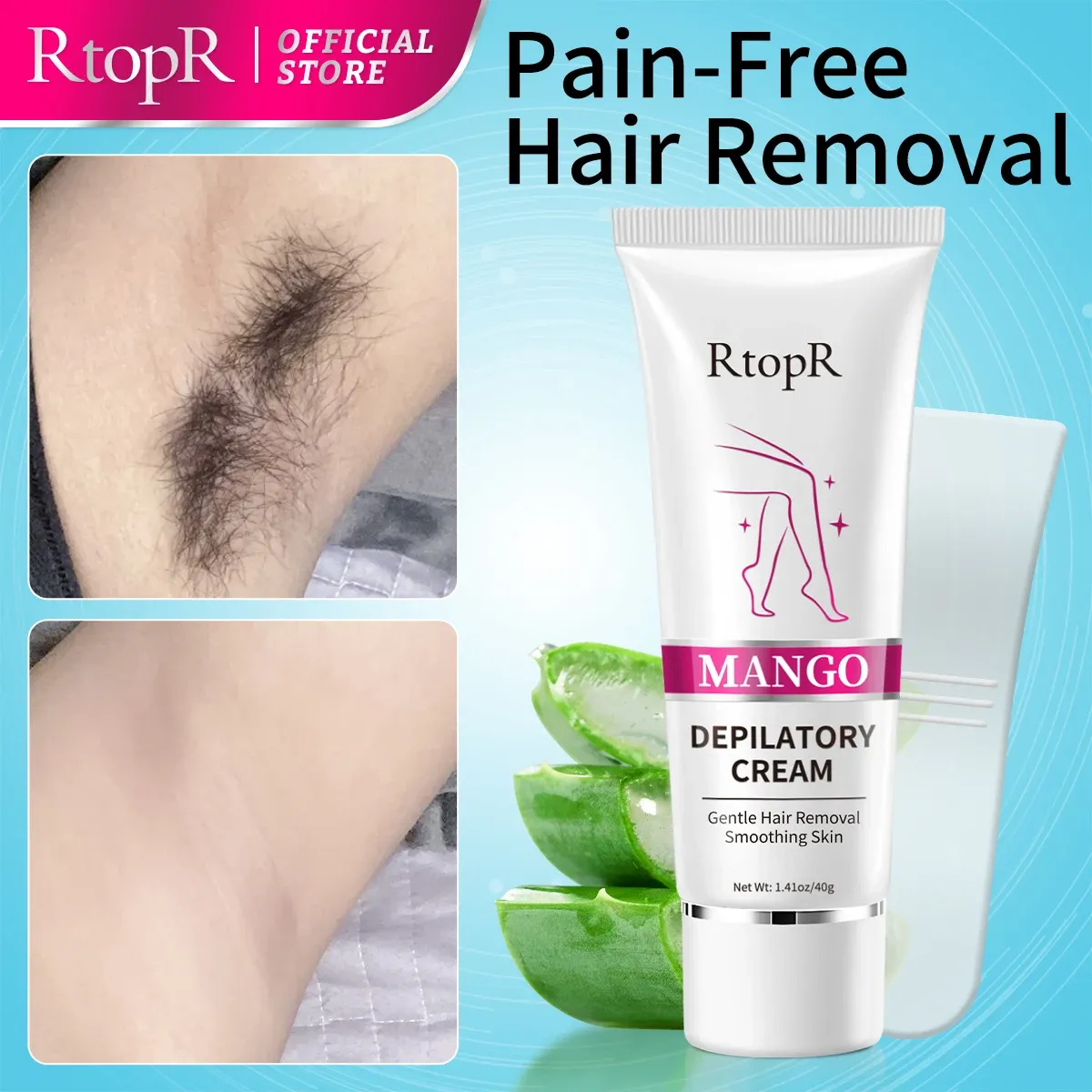RtopR Mango Hair Removal Cream for Arms, Legs and Underarms
