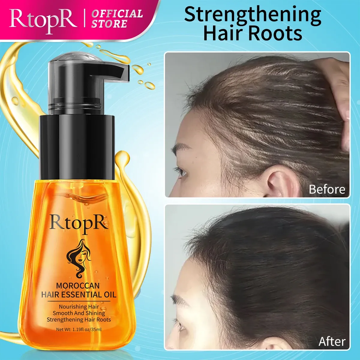 RtopR Moroccan Hair Care Essential Oil for Dry, Weak Hair